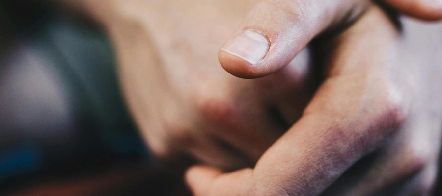Imagem do post Doenças das unhas: quais são e como preveni-las?